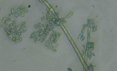 Cladosporium halotolerans LCE-02 (aumento de 40x)