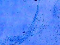 Fusarium solani LCE-05 (aumento de 40x)