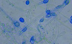 Isolado F4 - Fusarium sp. LCE-03 (aumento de 40x)