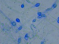 Isolado F4 - Fusarium sp. LCE-03 (aumento de 40x)