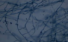 Isolado F5 - Fusarium sp. LCE-04 (aumento de 40x)