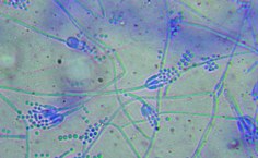 Penicillium gravinicasei LCE-06 (aumento de 40x)