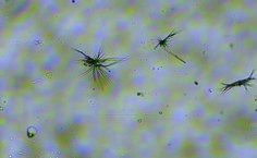 Ankistrodesmus sp. (aumento de 40x)