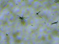 Ankistrodesmus sp. (aumento de 40x)