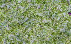 Isolado M1 (aumento de 10x)