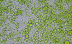 Isolado M2 (aumento de 40x)