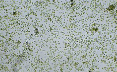 Isolado M2 (aumento de 10x)