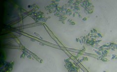 Cladosporium halotolerans LCE-02 - microscopia 40x