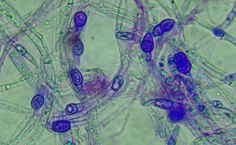 Fusarium keratoplasticum LCE-03 - microscopia 40x