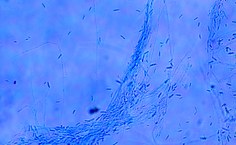 Fusarium solani LCE-05 - microscopia 40x