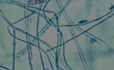 Fusarium sp. LCE-04 - microscopia 40x