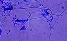 Penicillium gravinicasei LCE-06 - microscopia 40x